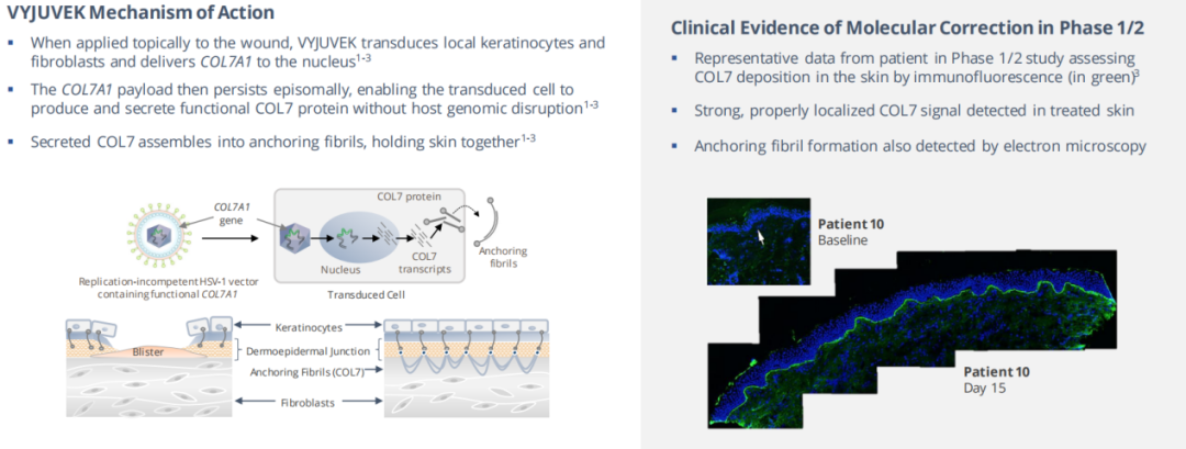 拯救“蝴蝶废物”！全球首款基因疗法来自一对“医药伉俪”